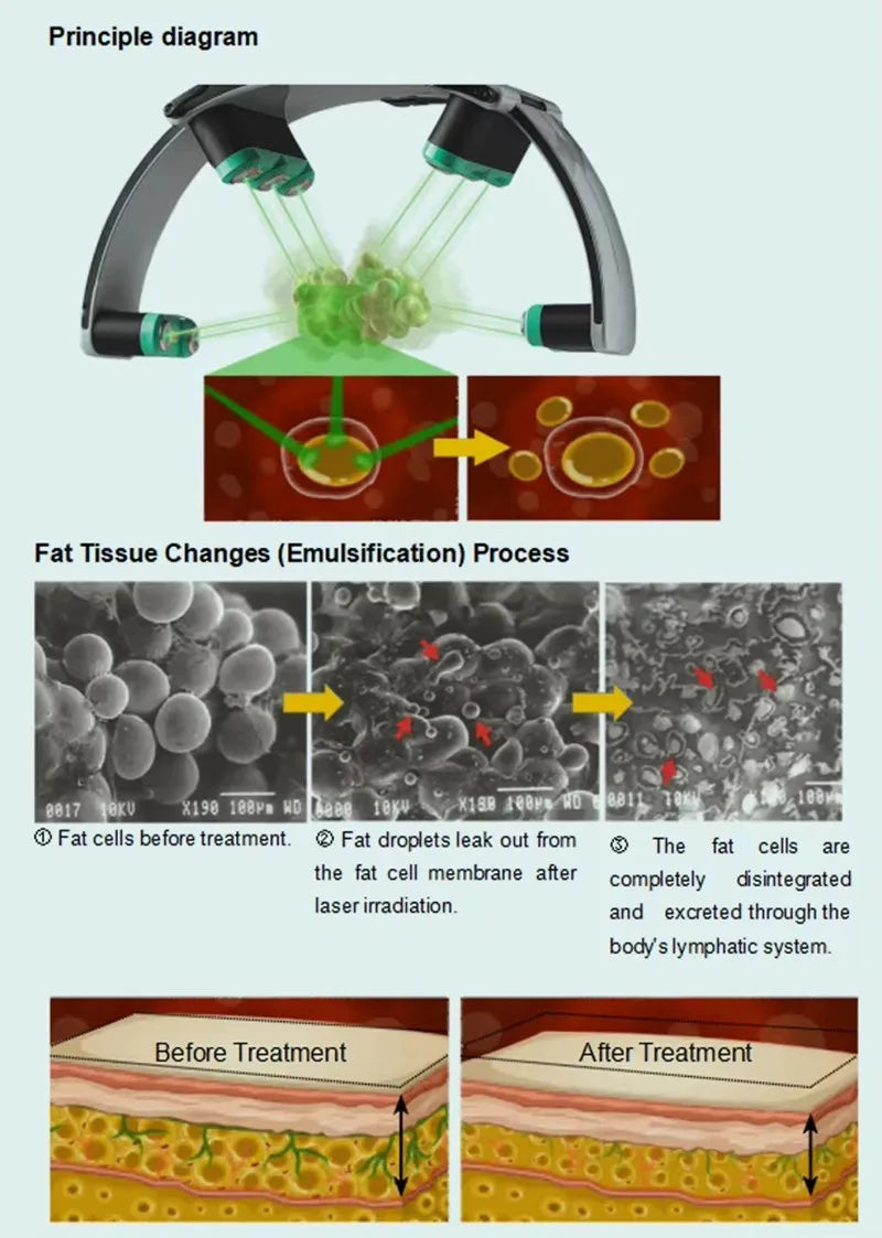 10D Master Non-invasive Weight Loss Slimming Machine Cellulite Fat Reduction Body Shape Pain Relief Physiotherapy