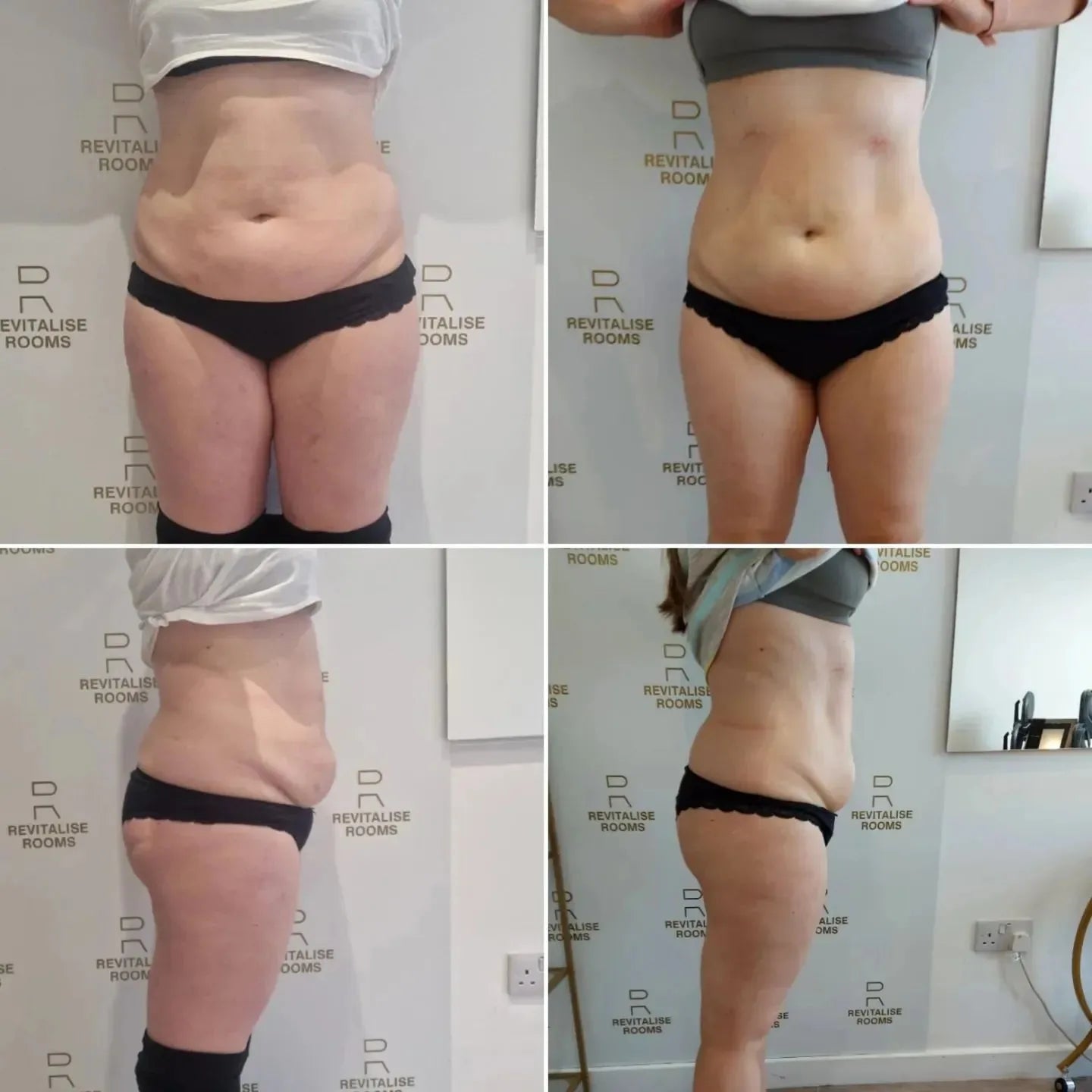 HIEMT EMSZERO RF High Intensity EVibration Pulse Electromagnetic Body Shaping Professional Muscle Growth And Fat Burning  Machin