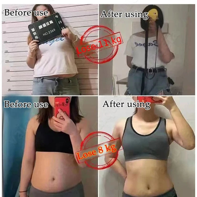 Herb Ball Fat Burning Slimming Patches Anti Cellulite Belly Detox Navel Sticker Weight Losing Fast Slim Plaster Slimming Product