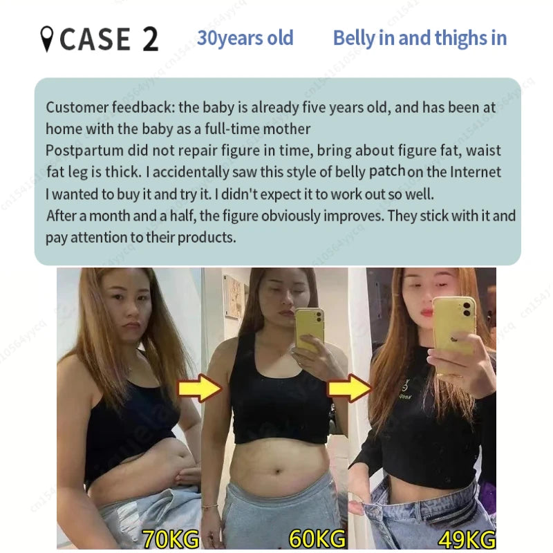 Herb Ball Fat Burning Slimming Patches Anti Cellulite Belly Detox Navel Sticker Weight Losing Fast Slim Plaster Slimming Product